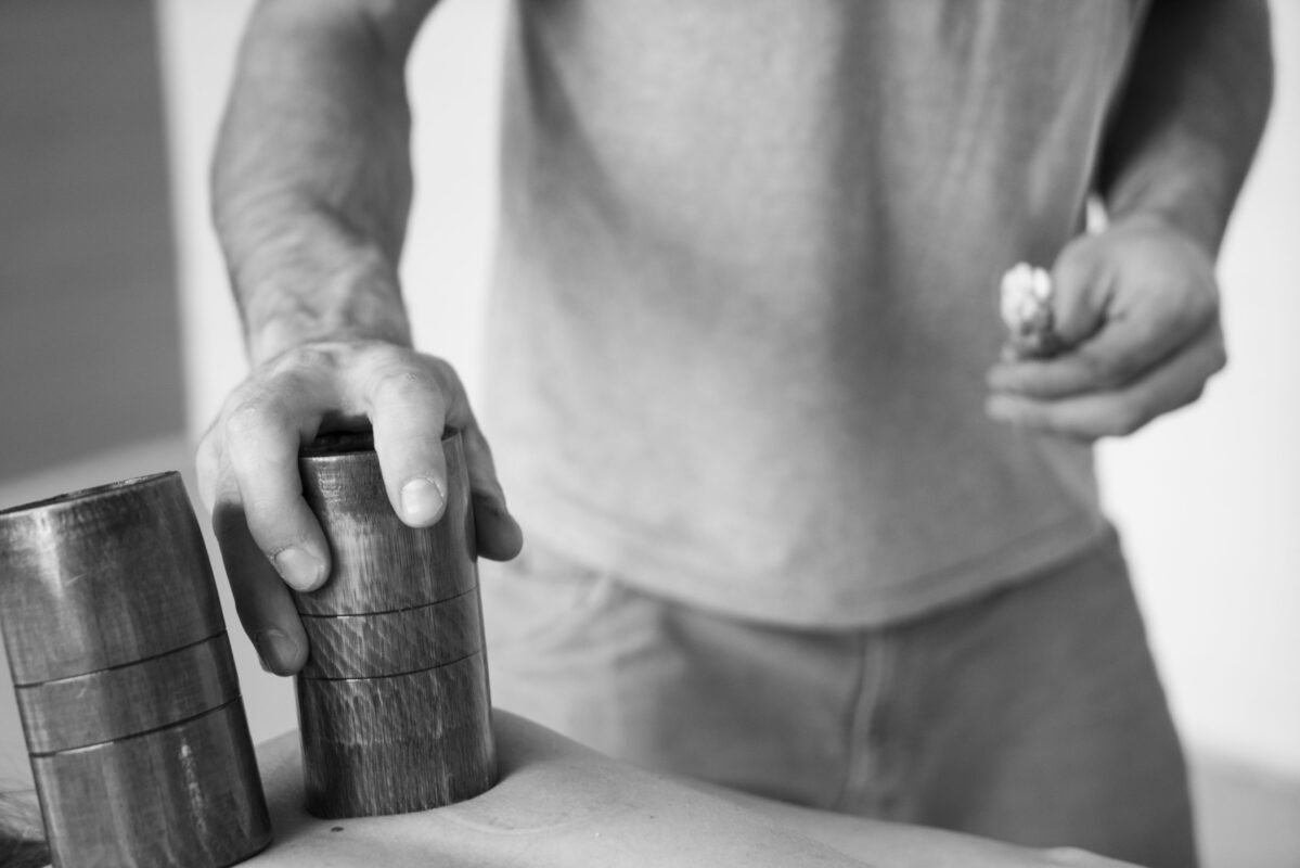 Schröpfen Naturheilpraxis